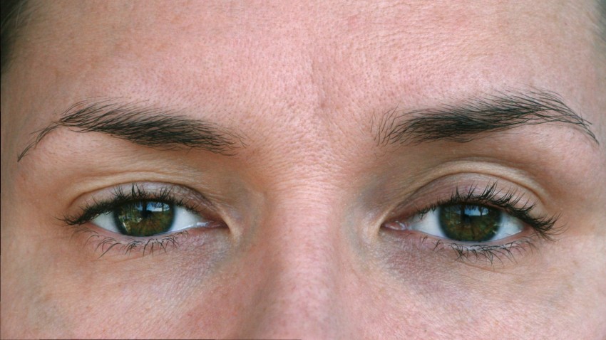 imagen de Primera solución oftalmológica con prescripción para párpados caídos